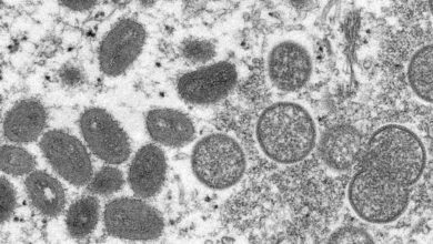 Photo de L’Organisation mondiale de la santé confirme 80 cas de monkeypox avec des épidémies dans 11 pays